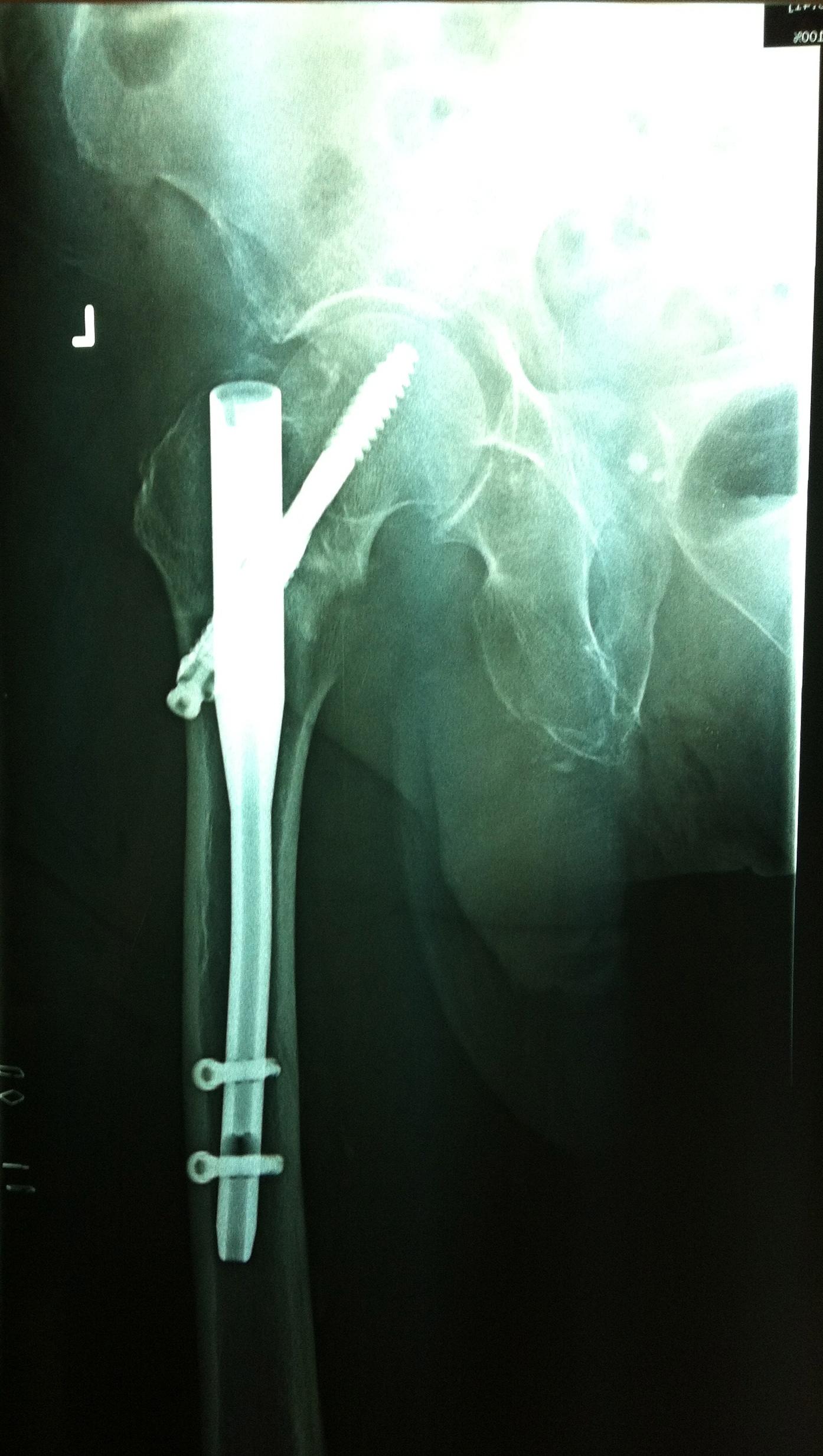 Post Image