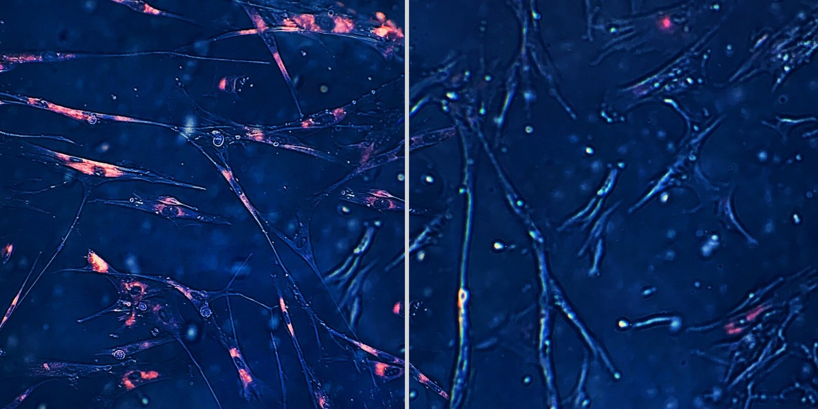 Acquisition Majeure De Sanofi : Un Nouvel Anticorps Bispécifique Ciblant Les Cellules Myéloïdes Acquisition Majeure De Sanofi : Un Nouvel Anticorps Bispécifique Ciblant Les Cellules Myéloïdes