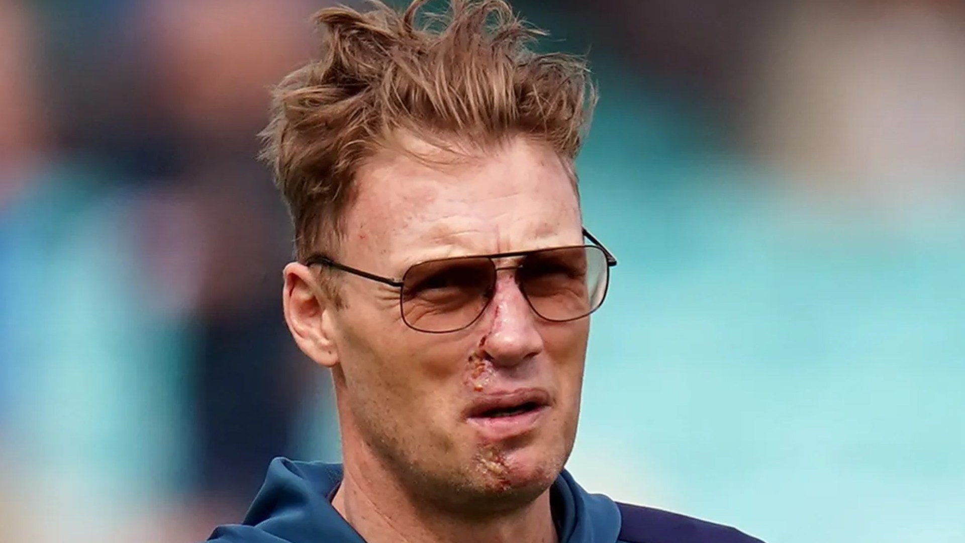 Freddie Flintoff: A Month Off After Devastating Top Gear Crash Freddie Flintoff: A Month Off After Devastating Top Gear Crash
