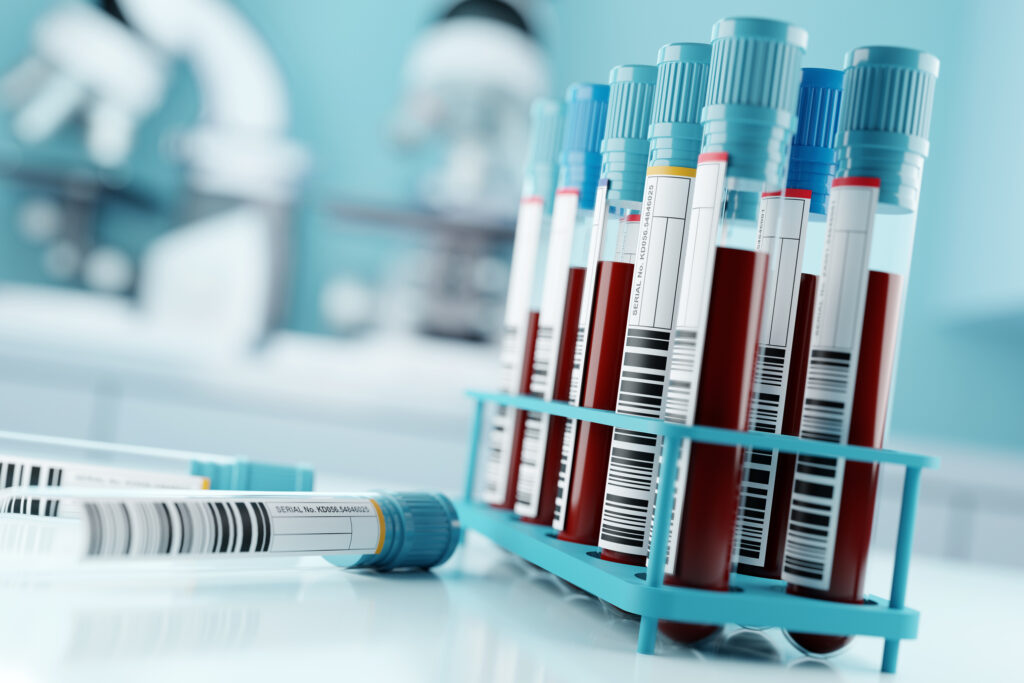 Guilty Plea: Lab Owner Admitted To COVID-19 Test Result Fraud Guilty Plea: Lab Owner Admitted To COVID-19 Test Result Fraud