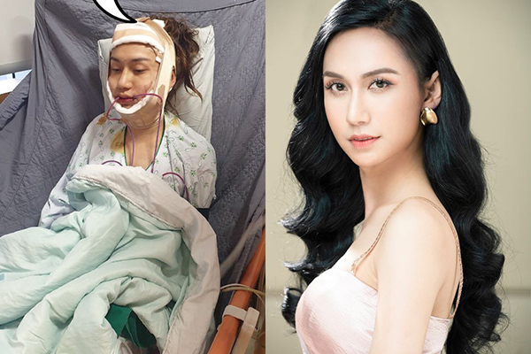 Hành Trình Chuyển Giới Của Lynk Lee: Sự Ủng Hộ Của Bạn Trai Và Nhan Sắc Ngày Càng Xinh Đẹp Hành Trình Chuyển Giới Của Lynk Lee: Sự Ủng Hộ Của Bạn Trai Và Nhan Sắc Ngày Càng Xinh Đẹp